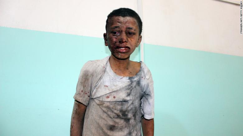 180810102214-12-yemen-schoolbus-airstrike-0809-exlarge-169.jpg
