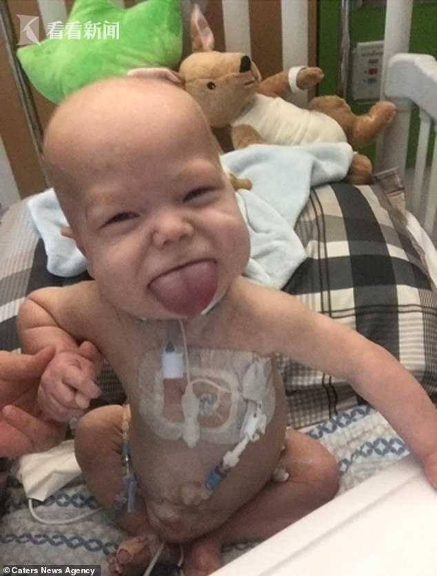 7a76b61784f36664a7cdd28fde18e52c.jpg 舌头4.jpg