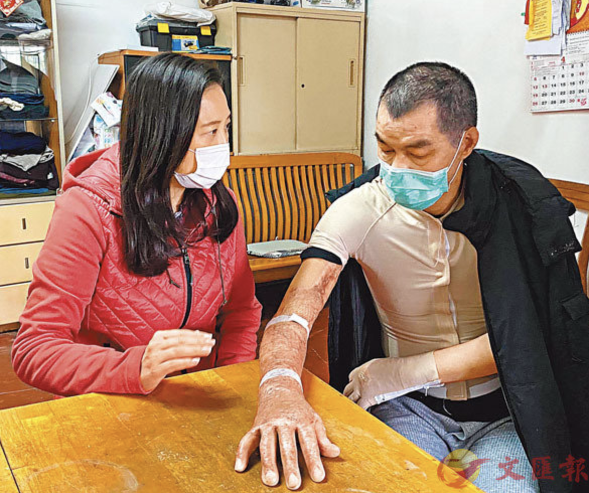 被暴徒放火烧伤的香港老伯首发声：痛恨煽暴政