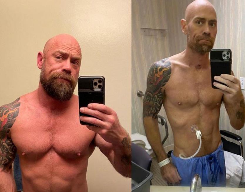 美国壮汉感染新冠病毒后暴瘦45斤 一度拿不动手