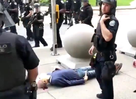 美国75岁老人被警察推倒头部流血 其律师：颅骨