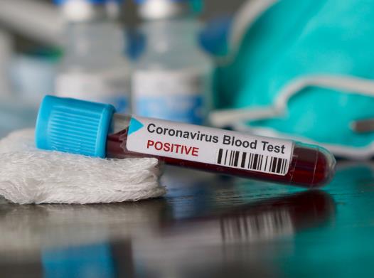 加拿大魁北克省宣布正面临第二波新冠肺炎疫情