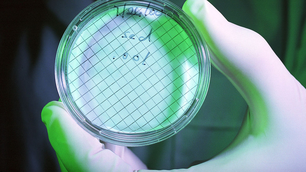 美国这地自来水遭致命微型变形虫入侵 官方紧急