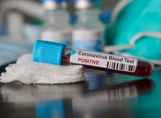 加拿大魁北克省新冠疫情二次暴发 剧院再次被关