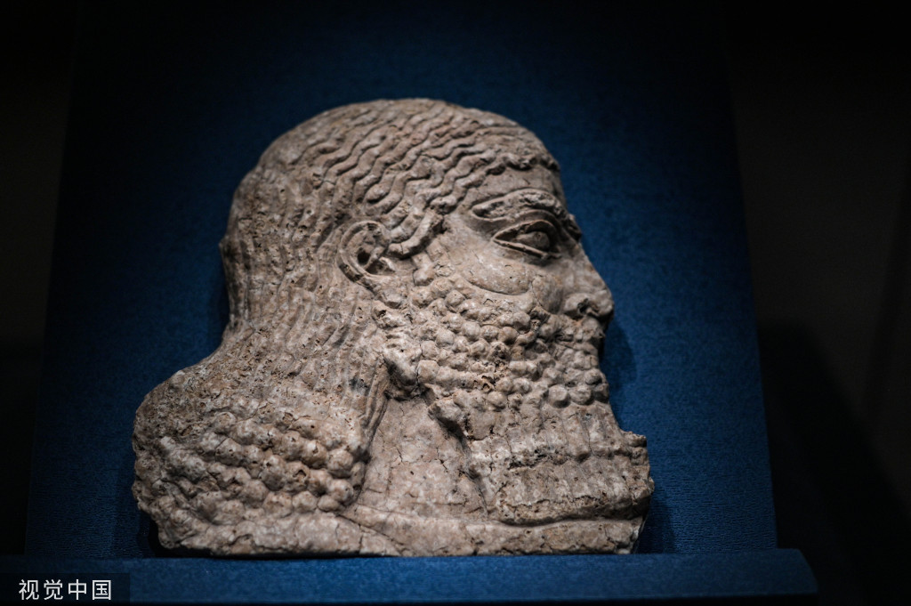 
南方医科大学南方医院黄牛代挂号电话票贩子号贩子网上预约挂号,住院检查加快,郑州展出四大文明古国珍贵文物203件