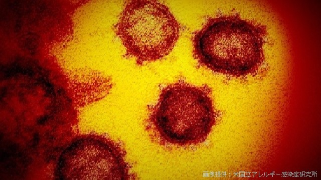 快讯！日本国内确诊新冠肺炎809例 死亡25例