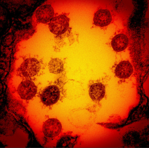 日本境内首次发现来自南非的变异新冠病毒