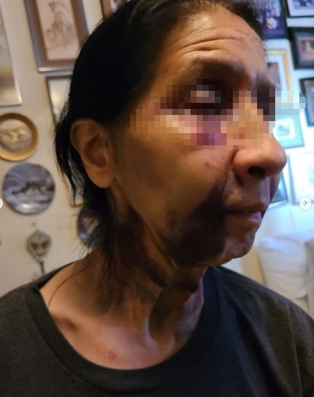 美国西裔老奶奶被误以为华人：公交上遭黑人暴打 无人施救