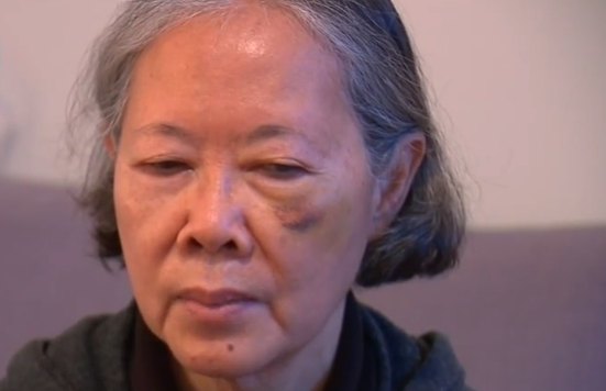 遭袭的美国亚裔老人（视频截图）