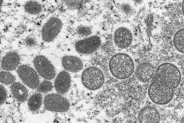 资料图：成熟的猴痘病毒(左)和未成熟病毒粒子(右)