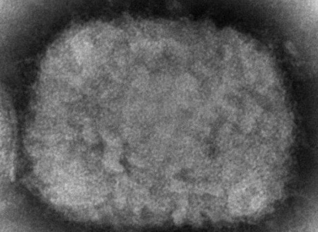 电子显微镜图像显示的猴痘病毒。（资料图）