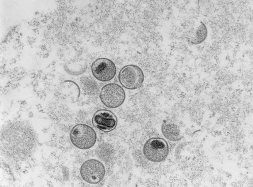 显微镜下的猴痘病毒（资料图）